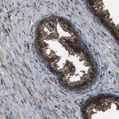 Immunohistochemistry-Paraffin: BMP-3b/GDF-10 Antibody [NBP1-88574]