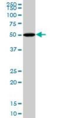 Western Blot: BMP-5 Antibody (1G6) [H00000653-M82]