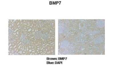 Immunohistochemistry: BMP-7 Antibody [NBP1-69126]
