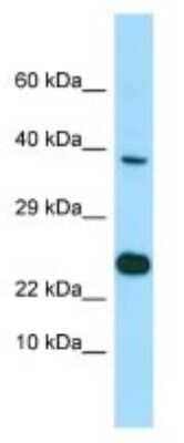 Western Blot: BMP-8b Antibody [NBP3-10678]