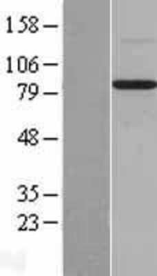 Western Blot: BMP-1/PCP Overexpression Lysate [NBL1-07998]