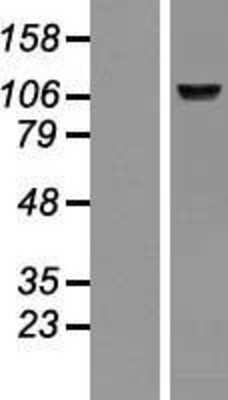 Western Blot: BMP-1/PCP Overexpression Lysate [NBP2-09828]