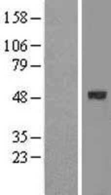 Western Blot: BMP-2 Overexpression Lysate [NBL1-07999]