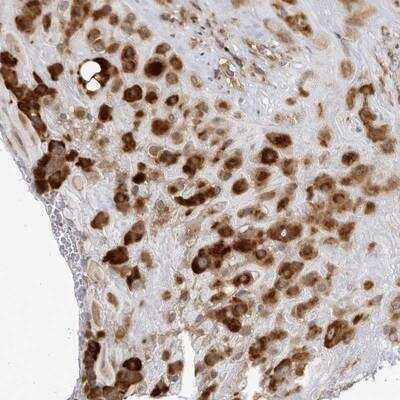 Immunohistochemistry: BMP2K Antibody [NBP1-88601]