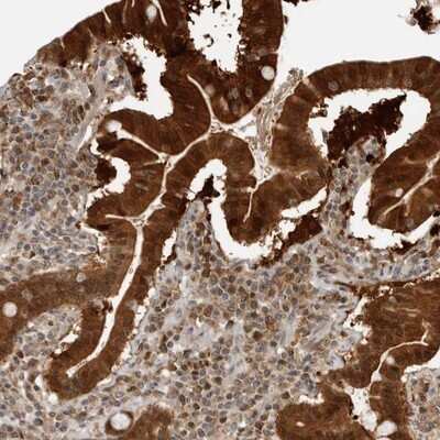 Immunohistochemistry-Paraffin: BMP2K Antibody [NBP1-88602]