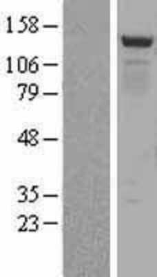 Western Blot: BMP2K Overexpression Lysate [NBL1-08000]