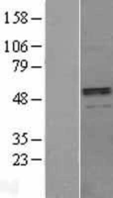 Western Blot: BMP-3 Overexpression Lysate [NBL1-08001]