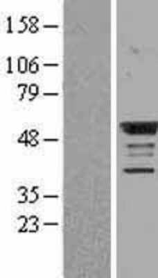 Western Blot: BMP-4 Overexpression Lysate [NBL1-08002]