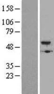 Western Blot: BMP-5 Overexpression Lysate [NBL1-08004]