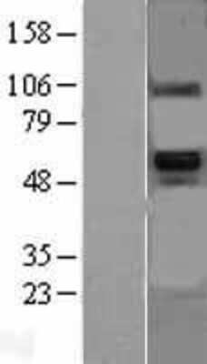 Western Blot: BMP-6 Overexpression Lysate [NBL1-08005]