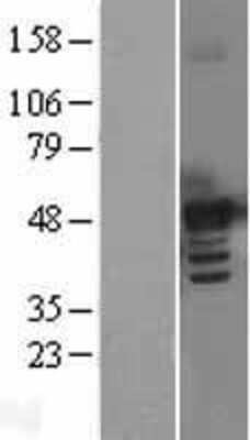 Western Blot: BMP-7 Overexpression Lysate [NBL1-08006]