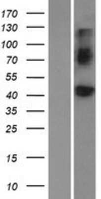 Western Blot: BMP-8a Overexpression Lysate [NBP2-04885]