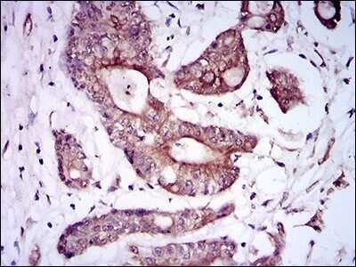 Immunohistochemistry-Paraffin: BMPR-IA/ALK-3 Antibody (4B7B2) - BSA Free [NBP2-37421]