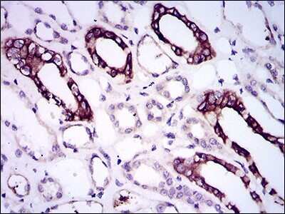 Immunohistochemistry-Paraffin: BMPR-IA/ALK-3 Antibody (4B7B2) - BSA Free [NBP2-37421]