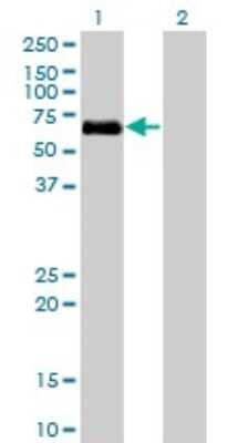 Western Blot: BMPR-IA/ALK-3 Antibody (4C4) [H00000657-M01]