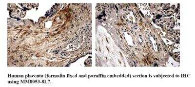 Immunohistochemistry: BMPR-IA/ALK-3 Antibody (MM0053-8L7) - Azide and BSA Free [NBP2-12029]