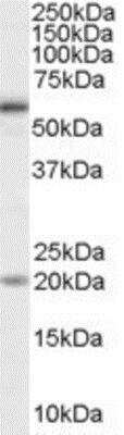 Western Blot: BMPR-IA/ALK-3 Antibody [NB100-41375]