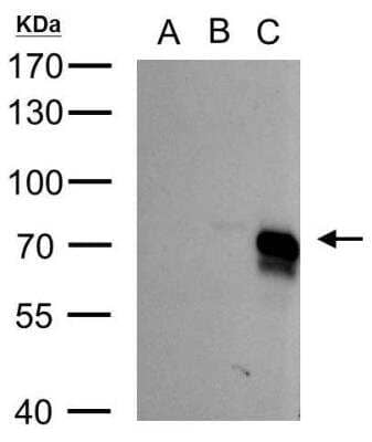 Western Blot: BMPR-IA/ALK-3 Antibody [NBP2-15601]