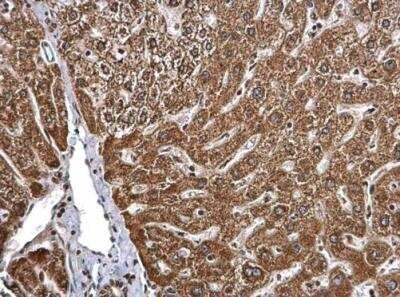 Immunohistochemistry-Paraffin: BMPR-IB/ALK-6 Antibody [NBP2-14889]