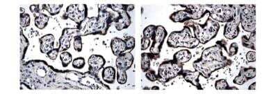 Immunohistochemistry-Paraffin: BMPR-IB/ALK-6 Antibody (MM0055-3E12) - Azide and BSA Free [NBP2-12031]