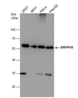 Western Blot: BMPR-IB/ALK-6 Antibody [NBP2-14889]