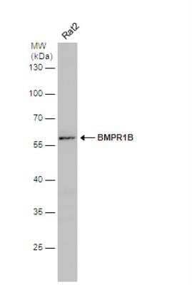 Western Blot: BMPR-IB/ALK-6 Antibody [NBP2-14889]