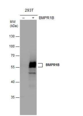 Western Blot: BMPR-IB/ALK-6 Antibody [NBP2-14889]