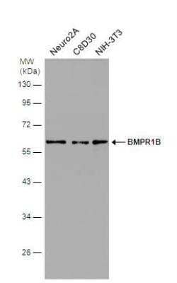 Western Blot: BMPR-IB/ALK-6 Antibody [NBP2-14889]