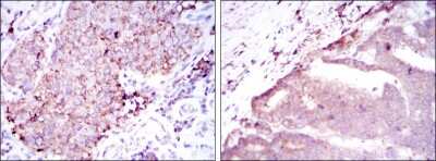 Immunohistochemistry-Paraffin: BMPR-II Antibody (1F12) - BSA Free [NBP2-37625]