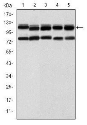 Western Blot: BMPR-II Antibody (1F12)BSA Free [NBP2-37625]