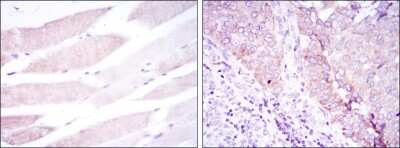 Immunohistochemistry-Paraffin: BMPR-II Antibody (3F6) - BSA Free [NBP2-37624]