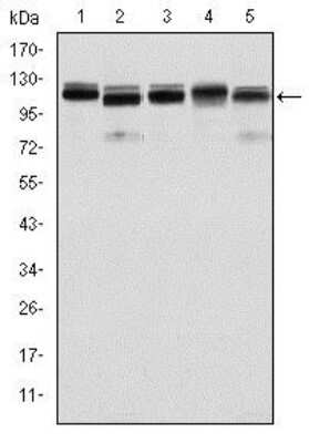 Western Blot: BMPR-II Antibody (3F6)BSA Free [NBP2-37624]