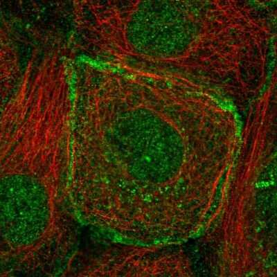 Immunocytochemistry/ Immunofluorescence: BMPR-II Antibody [NBP2-55020]