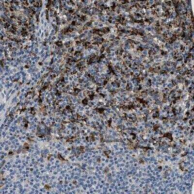 Immunohistochemistry-Paraffin: BMPR-II Antibody [NBP1-88572]