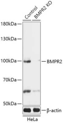 Knockout Validated: BMPR-II Antibody - Azide and BSA Free [NBP3-03627]