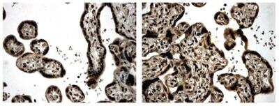 Immunohistochemistry-Paraffin: BMPR-II Antibody (MM0060-9A10) - Azide and BSA Free [NBP2-12064]