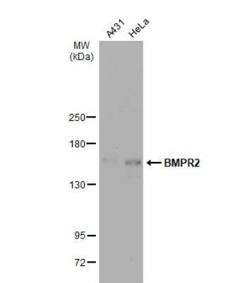 Western Blot: BMPR-II Antibody [NBP1-32218]