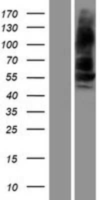 Western Blot: BMPR-IB/ALK-6 Overexpression Lysate [NBP2-08226]