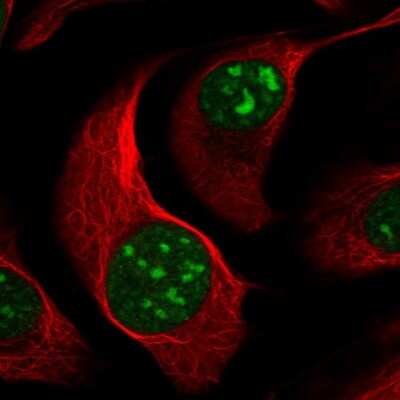 Immunocytochemistry/ Immunofluorescence: BMS1 Antibody [NBP2-37903]