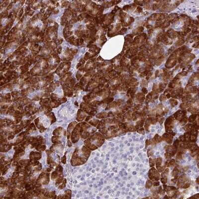 Immunohistochemistry: BMS1 Antibody [NBP2-37903]
