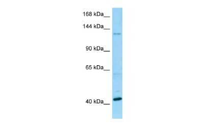 Western Blot: BMS1 Antibody [NBP2-82764]