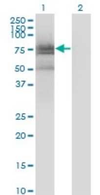 Western Blot: BMX Antibody (3G3) [H00000660-M01]