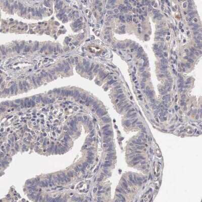 Immunohistochemistry-Paraffin: BMX Antibody [NBP1-84778]