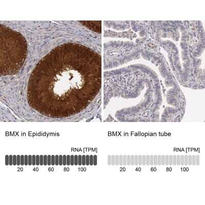 Immunohistochemistry-Paraffin: BMX Antibody [NBP1-84778]