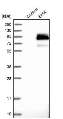 Western Blot: BMX Antibody [NBP1-84778]