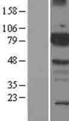 Western Blot: BMX Overexpression Lysate [NBL1-08010]