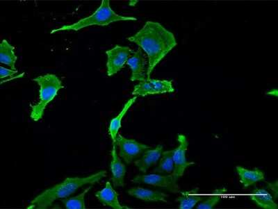 Immunocytochemistry/ Immunofluorescence: BNC1 Antibody (1F4) [H00000646-M03]