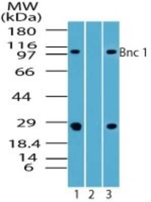 Western Blot: BNC1 Antibody [NBP2-24721]