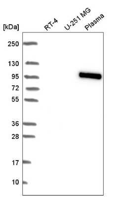 Western Blot: BNC1 Antibody [NBP2-57360]