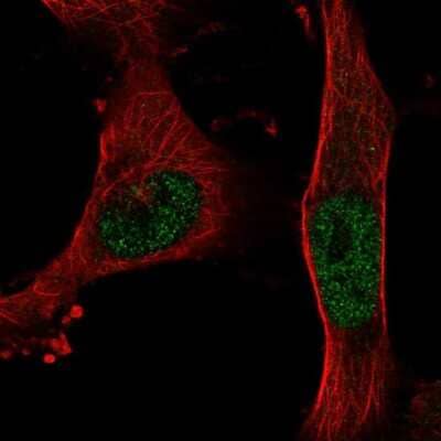 Immunocytochemistry/ Immunofluorescence: BNC2 Antibody [NBP2-68753]